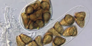 microscopic view of Freshwater Fungi
