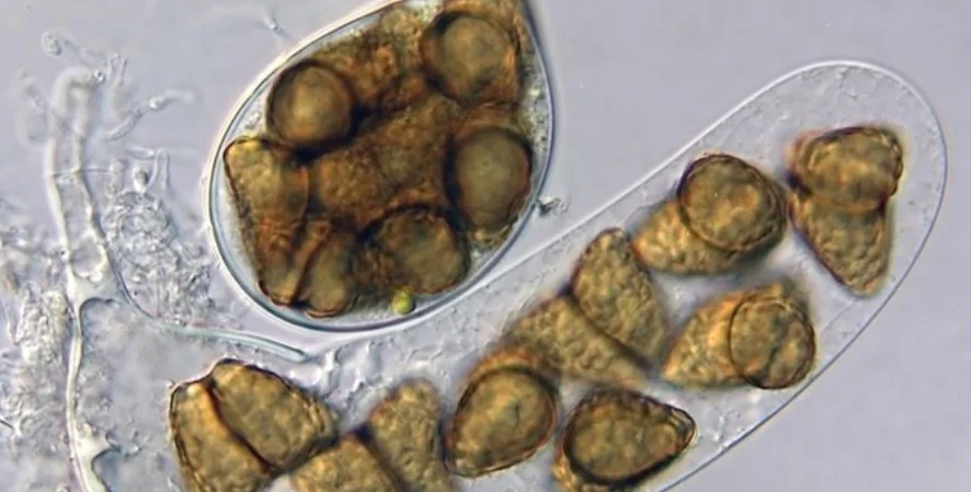 microscopic view of Freshwater Fungi