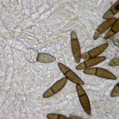 Jahnula apiospora fungi microscopic view