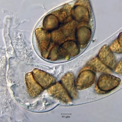 microscopic view of freshwater fungi